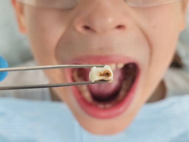 Best Emergency Gum Treatment in Rupert, ID